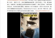 9岁女生胃里取出1斤多头发：开始喜欢吃头发 家长未重视-融党建互动平台