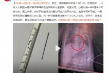 女婴心脏扎进一根4厘米绣花针 家长不知是如何进入体内-融党建互动平台