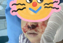 奶奶向3岁男童鼻腔塞头发止血 血没止住人送医时已休克-融党建互动平台