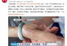 女子戴玉镯10年关节变形成手铐 最后还是敲碎了-融党建互动平台