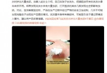 女生称海飞丝洗发水挤出大量虫卵 客服：或从泵嘴进入-融党建互动平台