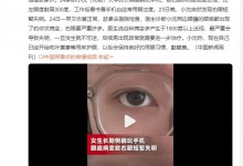 女子长期侧躺玩手机致右眼短暂失明 网友：立刻下单叶黄素-融党建互动平台