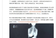 杭州12岁女孩1米72脊柱歪到要手术 网友：肉眼可见的歪-融党建互动平台