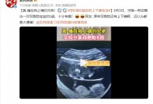 孕妇做B超拍到上下铺宝宝 网友：真·睡在我上铺的兄弟-融党建互动平台