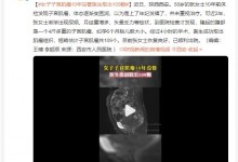 女子子宫肌瘤10年没管医生取出109颗 腹部隆起如孕胎儿-融党建互动平台
