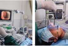 女子咳嗽半月 气管发现8cm蚂蟥 取出时还在蠕动(图)-融党建互动平台