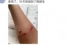 河南多地已发现隐翅虫：被称为“飞行的硫酸” 需警惕-融党建互动平台