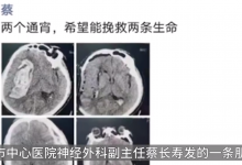 医生发朋友圈2个通宵救2命称自豪 网友：医者仁心-融党建互动平台