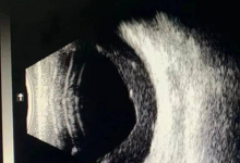 35岁小伙太爱喝饮料致双目失明 一直仗着年轻-融党建互动平台