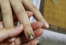 19岁女子被骗缅甸获救时遍体鳞伤 遭多次殴打转卖-融党建互动平台