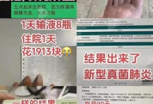 女子闻刚脱下的袜子感染真菌肺炎：吃药90天，咳了60天-融党建互动平台