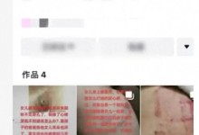 女孩留宿女同事家被爸爸打致耳穿孔 不愿诉诸法律-融党建互动平台