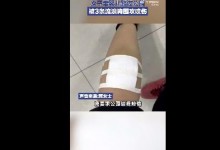 女子带娃路过公园被3条流浪狗围攻 公园：保安有经常巡逻-融党建互动平台