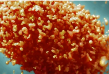 10月新增报告127例猴痘确诊病例 98.2%病例为男性-融党建互动平台