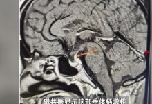 男子每天喝30斤水去50次厕所 喝水要用盆来接-融党建互动平台