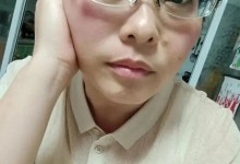 断崖式衰老女子本以为能漂亮过余生 没想到当头一棒-融党建互动平台