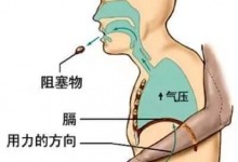 女子在美容店内吃毛蛋被卡 店主第一次用海姆立克、就救了她-融党建互动平台