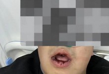 小伙群内“吐槽”物业被多人上门扇嘴巴？ 警方介入调查-融党建互动平台