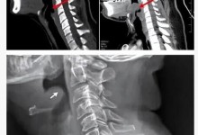 近期高发的嗓子疼可能是这种急症 可能瞬间“封喉”-融党建互动平台