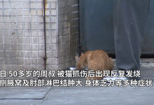 男子被猫抓伤后确诊“猫抓病” 反复发烧没能痊愈-融党建互动平台