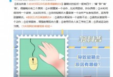 长时间玩手机容易得腱鞘炎 腱鞘炎症状表现是什么？-融党建互动平台