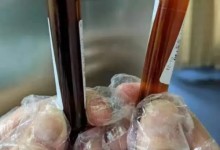 95后女生腹痛难忍口吐“黑水” 被称作吸血鬼病-融党建互动平台