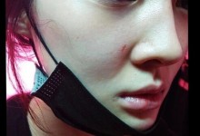 Tara李雅凛试图自杀被送医 曝前夫严重虐待孩子-融党建互动平台