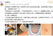 王灿被烫伤 网友：这个位置最好别坐人-融党建互动平台