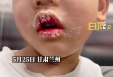 男童不慎把502胶水抹嘴巴胳膊上 妈妈：幸好胶水没入眼-融党建互动平台