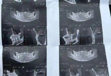 女生实习时晕倒摔断4颗牙齿 8万多医疗费谁承担？-融党建互动平台